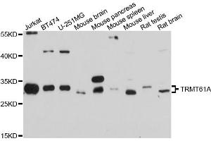 Western blot analysis of extracts of various cell lines, using TRMT61A antibody. (TRMT61A antibody)