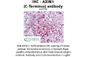 Image no. 1 for anti-Axin 1 (AXIN1) (C-Term) antibody (ABIN1732156) (Axin antibody  (C-Term))