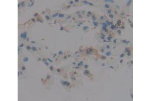 Figure. (KRT81 antibody  (AA 142-257))