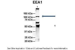Amount and Sample Type :  500 ug rat brain homogenate  Amount of IP Antibody :  6 ug  Primary Antibody :  EEA1  Primary Antibody Dilution :  1:500  Secondary Antibody :  Goat anti-rabbit Alexa-Fluor 594  Secondary Antibody Dilution :  1:5000  Gene Name :  EEA1  Submitted by :  Dr. (EEA1 antibody  (N-Term))