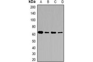 Western blot analysis of CD36 expression in MCF7 (A), A431 (B), mouse brain (C), mouse lung (D) whole cell lysates. (CD36 antibody)