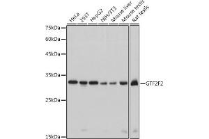Western blot analysis of extracts of various cell lines, using GTF2F2 antibody (ABIN7267373) at 1:1000 dilution. (GTF2F2 antibody)