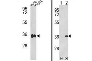 (LEFT) Western blot analysis of MDH1 Antibody (C-term) in HL-60, HepG2 cell line lysates (35ug/lane). (MDH1 antibody  (C-Term))