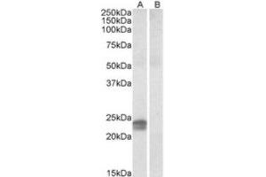 Western Blotting (WB) image for anti-High Mobility Group AT-Hook 1 (HMGA1) (Internal Region) antibody (ABIN2464248) (HMGA1 antibody  (Internal Region))