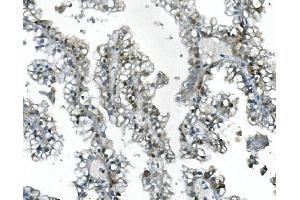 IHC analysis of UBR2 using anti-UBR2 antibody (ABIN7599609). (UBR2 antibody  (AA 10-664))