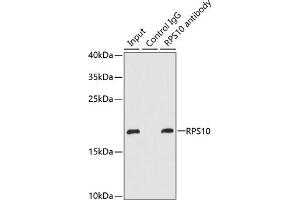 Immunoprecipitation analysis of 200 μg extracts of MCF-7 cells using 1 μg RPS10 antibody (ABIN6132944, ABIN6147191, ABIN6147193 and ABIN6221584). (RPS10 antibody  (AA 1-165))