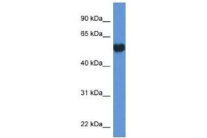 Western Blot showing GPI antibody used at a concentration of 1 ug/ml against HepG2 Cell Lysate (GPI antibody  (C-Term))
