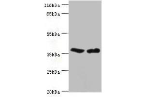 Western blot All lanes: CA5B antibody at 2 μg/mL Lane 1: Mouse liver tissue Lane 2: Mouse kidney tissue Secondary Goat polyclonal to rabbit IgG at 1/10000 dilution Predicted band size: 36 kDa Observed band size: 36 kDa