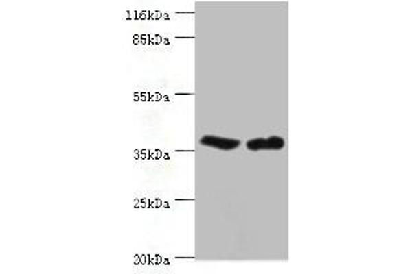 CA5B anticorps  (AA 34-314)