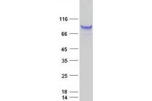 Validation with Western Blot (NFATC1 Protein (Transcript Variant 1) (Myc-DYKDDDDK Tag))