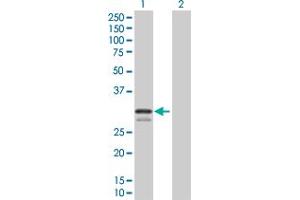 Lane 1: KLK3 transfected lysate ( 28. (KLK3 293T Cell Transient Overexpression Lysate(Denatured))