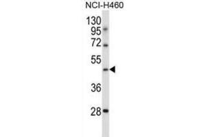Western Blotting (WB) image for anti-Transducin-Like Enhancer of Split 6 (TLE6) antibody (ABIN2997351)