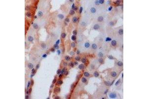 Immunohistochemical analysis of PSTPIP1 staining in mouse kidney formalin fixed paraffin embedded tissue section. (PSTPIP1 antibody)