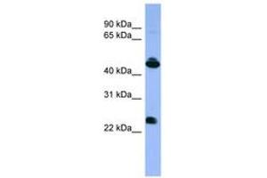 Image no. 1 for anti-Opsin 1 (Cone Pigments), Medium-Wave-Sensitive (OPN1MW) (C-Term) antibody (ABIN6746666) (OPN1MW antibody  (C-Term))