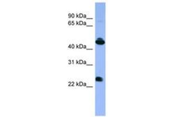 OPN1MW anticorps  (C-Term)
