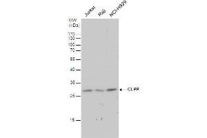 WB Image CLPP antibody detects CLPP protein by western blot analysis.