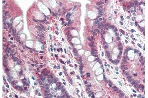 ABIN571002 (5 μg/mL) staining of paraffin embedded Human Small Intestine. (PSMB10 antibody  (Internal Region))