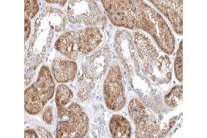 Immunohistochemistry (IHC) image for anti-Midline 1 (MID1) (N-Term) antibody (ABIN6265724)