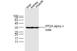 Lane 1: Liver lysates Lane 2: Kidney lysates Lane 3: Muscle lysates probed with PP2A alpha + beta Polyclonal Antibody, Unconjugated  at 1:300 dilution and 4˚C overnight incubation. (PP2A alpha/beta antibody  (AA 205-309))