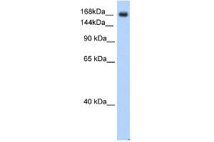 WB Suggested Anti-SCN5A Antibody Titration:  0. (SCN5A antibody  (C-Term))