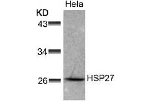 Image no. 1 for anti-Heat Shock 27kDa Protein 1 (HSPB1) (AA 76-80) antibody (ABIN197488) (HSP27 antibody  (AA 76-80))