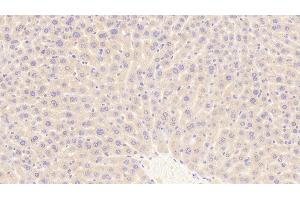 Detection of TFR in Mouse Liver Tissue using Polyclonal Antibody to Transferrin Receptor (TFR) (Transferrin Receptor antibody  (AA 572-757))