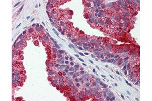 Anti-APEH antibody IHC of human prostate. (APEH antibody  (AA 144-193))