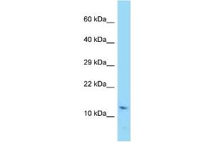 WB Suggested Anti-Rprml Antibody Titration: 1. (RPRML antibody  (Middle Region))