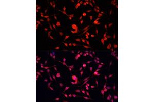 Immunofluorescence analysis of NIH/3T3 cells using YB-1/YB-1/YBX1 antibody (ABIN7271411) at dilution of 1:100. (YBX1 antibody  (AA 100-200))