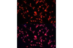 Immunofluorescence analysis of NIH/3T3 cells using YB-1/YB-1/YBX1 antibody (ABIN7271411) at dilution of 1:100. (YBX1 antibody  (AA 100-200))