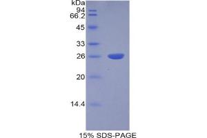 SDS-PAGE analysis of Human Cathepsin S Protein.