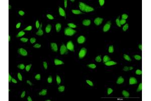 Immunofluorescence of purified MaxPab antibody to C12orf24 on HeLa cell. (C12ORF24 antibody  (AA 1-273))