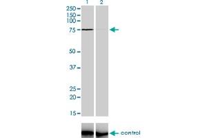 Western blot analysis of ZNF281 over-expressed 293 cell line, cotransfected with ZNF281 Validated Chimera RNAi (Lane 2) or non-transfected control (Lane 1).