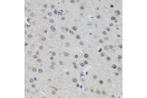 Immunohistochemistry of paraffin-embedded mouse brain using MYCN antibody. (MYCN antibody)