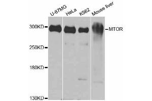 Western blot analysis of extracts of various cell lines, using MTOR antibody. (MTOR antibody)