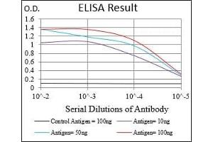 Black line: Control Antigen (100 ng), Purple line: Antigen(10 ng), Blue line: Antigen (50 ng), Red line: Antigen (100 ng),