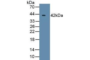 Detection of Recombinant Bcl7A, Human using Polyclonal Antibody to B-Cell CLL/Lymphoma 7A (Bcl7A) (BCL7A antibody  (AA 1-210))
