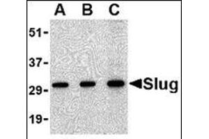 Western blot analysis of Slug in 293 cell lysate with this product at in (A) 0. (SLUG antibody  (Center))