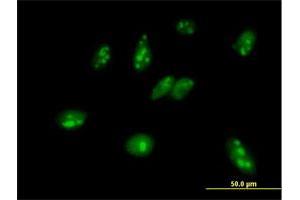 Immunofluorescence of purified MaxPab antibody to MPHOSPH6 on HeLa cell. (MPHOSPH6 antibody  (AA 1-160))