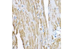 Immunohistochemistry of paraffin-embedded rat heart using S Rabbit pAb (ABIN1682619, ABIN3017779, ABIN3017780 and ABIN6220246) at dilution of 1:200 (40x lens). (SAMM50 antibody  (AA 1-220))