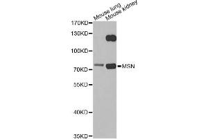 Western blot analysis of extracts of various cell lines, using MSN antibody. (Moesin antibody)