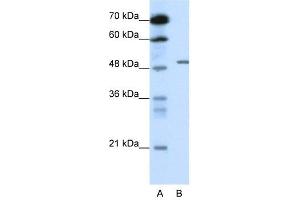 GABRB2 antibody used at 0. (GABRB2 antibody)