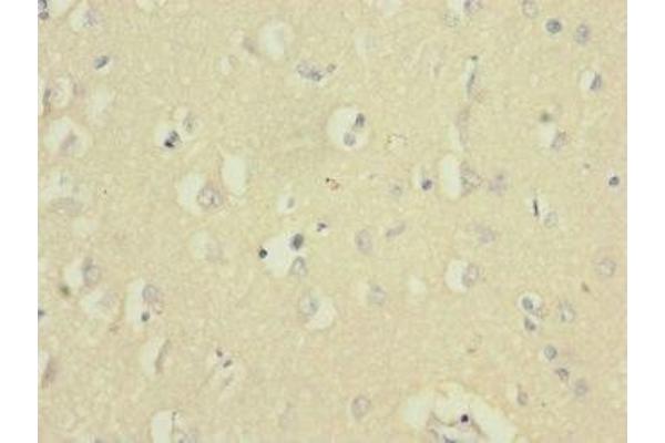 UBE2F antibody  (AA 1-185)