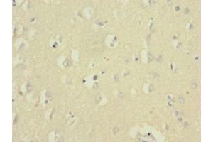Immunohistochemistry of paraffin-embedded human brain tissue using ABIN7161138 at dilution of 1:100 (UBE2F antibody  (AA 1-185))