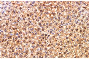Immunohistochemistry of paraffin-embedded Mouse liver using S100A11 Polyclonal Antibody at dilution of 1:200 (S100A11 antibody)