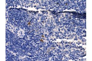 ABIN6259651 and ABIN6268999 at 1/100 staining Mouse spleen tissue by IHC-P. (Serotonin Receptor 1A antibody  (Internal Region))