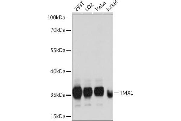 TMX1 anticorps  (AA 210-280)