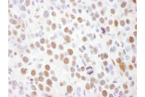 Immunohistochemistry (IHC) image for anti-RAD17 (RAD17) (pSer645) antibody (ABIN7449387) (RAD17 antibody  (pSer645))
