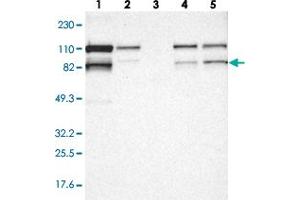 Western blot analysis of Lane 1: RT-4, Lane 2: U-251 MG, Lane 3: Human Plasma, Lane 4: Liver, Lane 5: Tonsil with VEZT polyclonal antibody  at 1:250-1:500 dilution. (VEZT antibody)