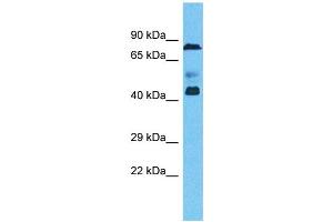 ZNF362 antibody  (N-Term)